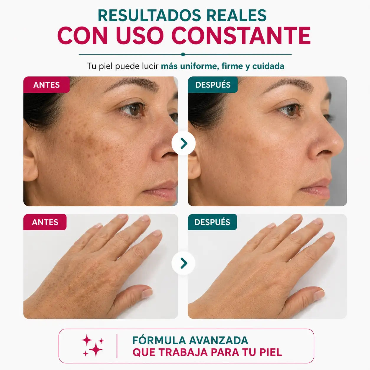 COMBO ACIDO KOJICO RUTINA ANTIMANCHAS