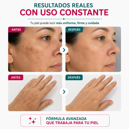 COMBO ACIDO KOJICO RUTINA ANTIMANCHAS