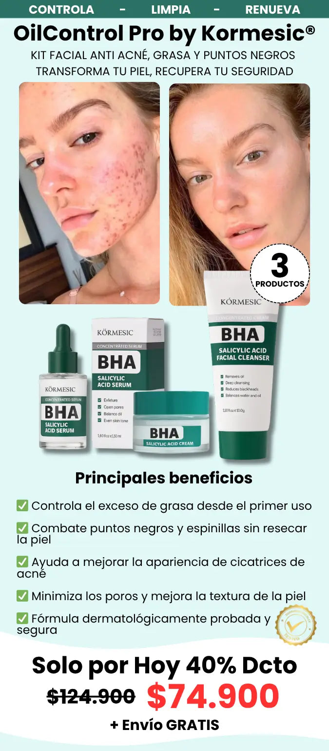 OilControl Pro antes y después - Kormesic